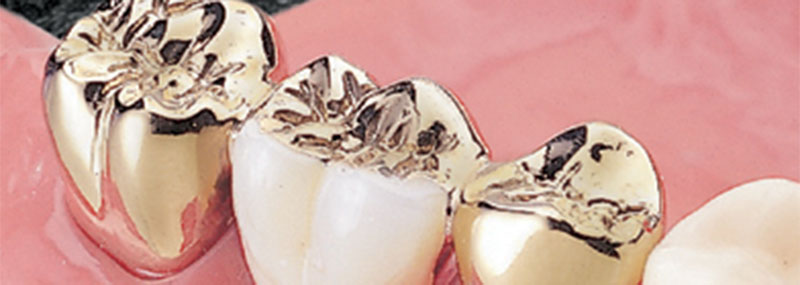 金属アレルギー